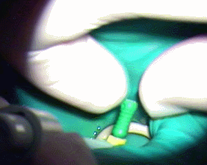 ヤスリ掛け ファイリング中 2016.06.30.gif